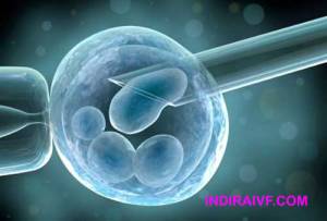 Test tube baby process - what is the cost of test tube baby in india