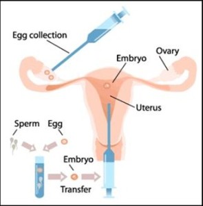 IVF and Blastocyst Transfer in Udaipur , Delhi & Pune at Indira Infertility Clinic